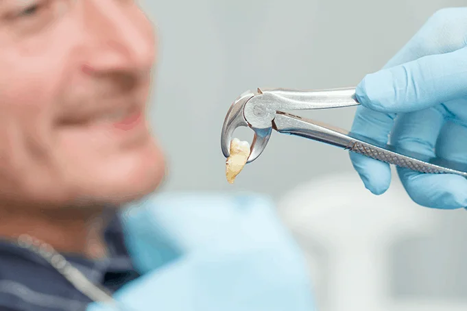 Extractions